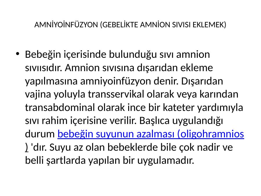 Akademik Sunum