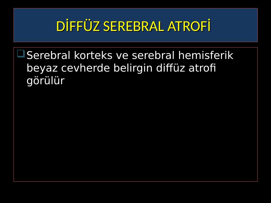Serebral atrofi ekşi